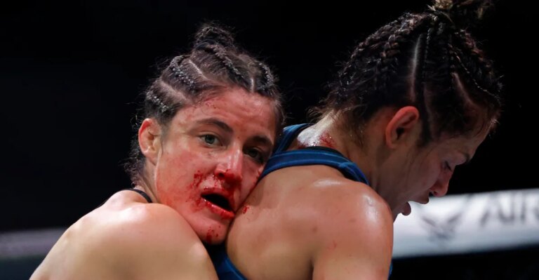 Loopy Godinez hospitalized after UFC Vegas 122 Loopy Godinez hospitalized after UFC Vegas 122